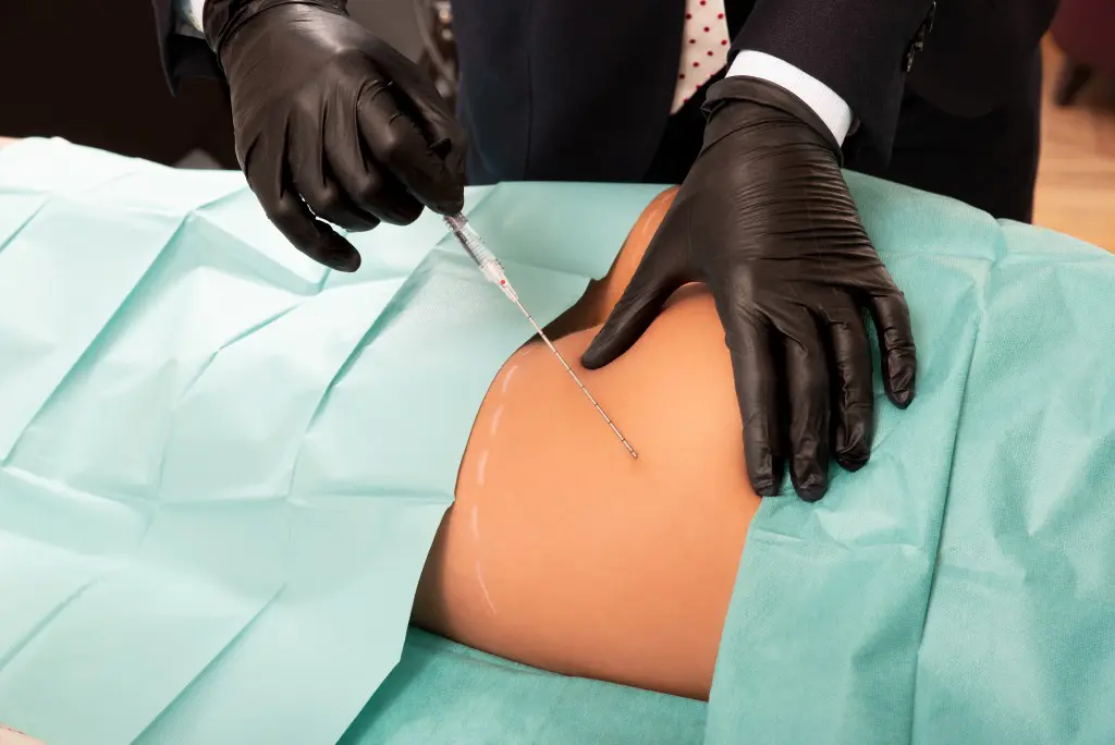 buttocks injection with microcannula